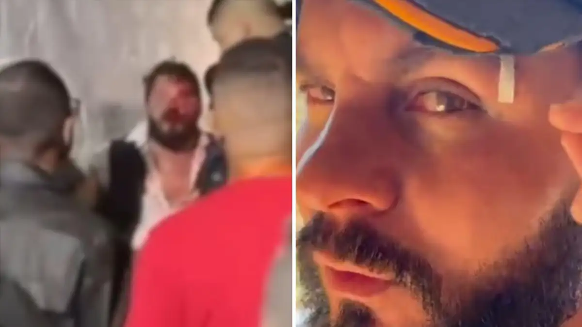Cantor Erick Lins afirma que vida virou “filme de terror” após agressão por produtor de Eduardo Costa