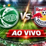 Onde assistir Juventude x Bragantino Ao Vivo hoje